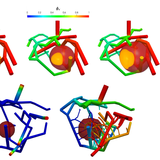 Modeling tumor growth, angiogenesis, drug-therapy, metastasis